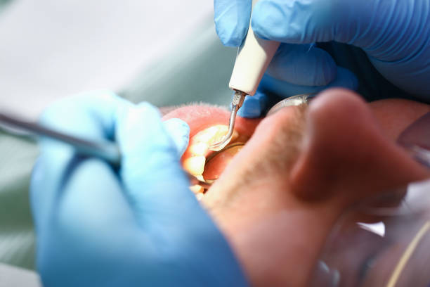 Best Emergency Treatment for Oral Infections in Annetta, TX